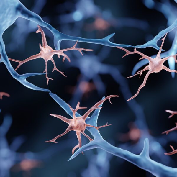 Differences between microglia of the brain’s white and grey matter in Multiple Sclerosis