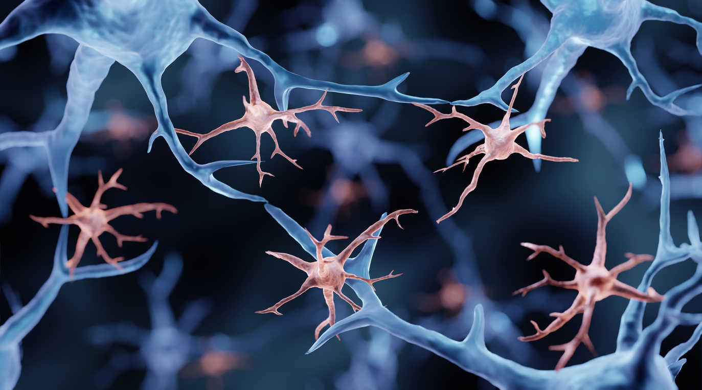 Differences between microglia of the brain’s white and grey matter in Multiple Sclerosis