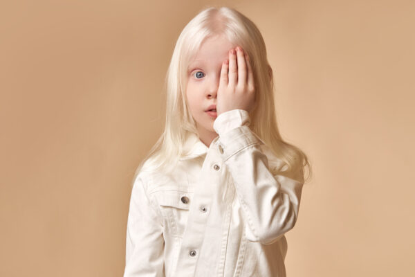 beautiful albino child closed her eye